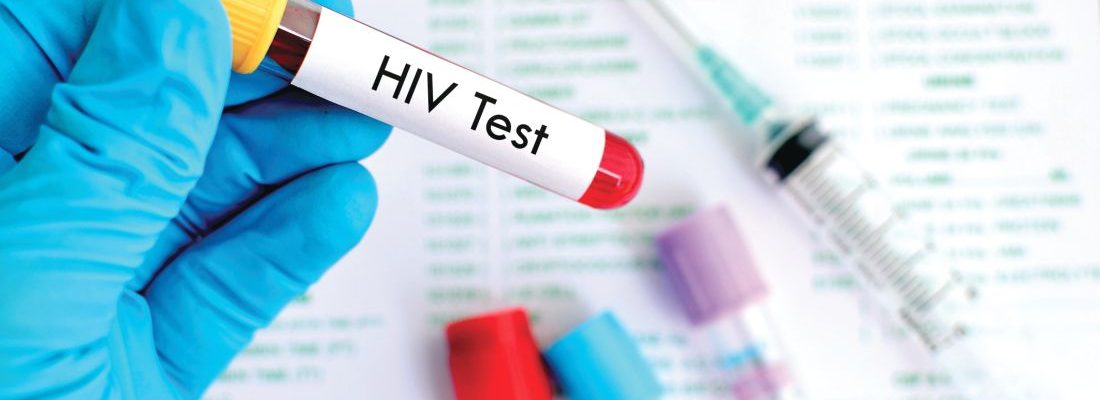 Malalaman ba kung HIV positive sa urine o blood test?