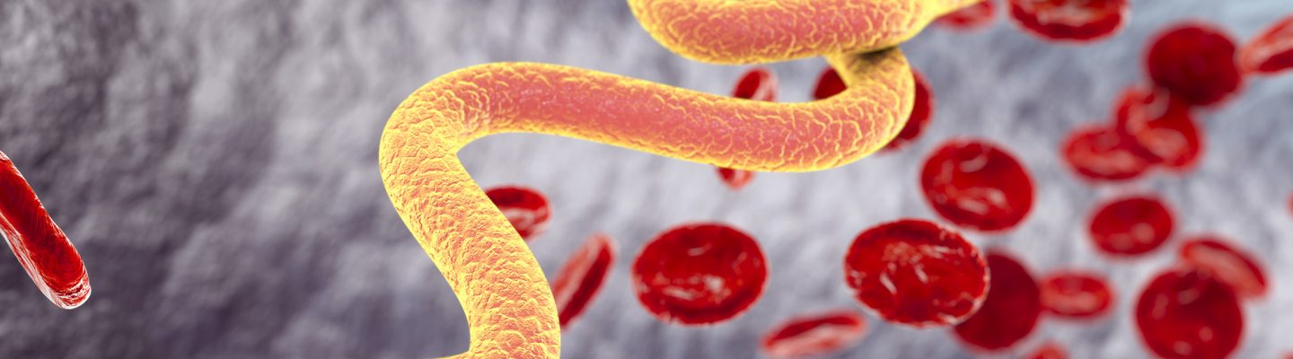 Paano malaman kung may filariasis o elephantiasis?