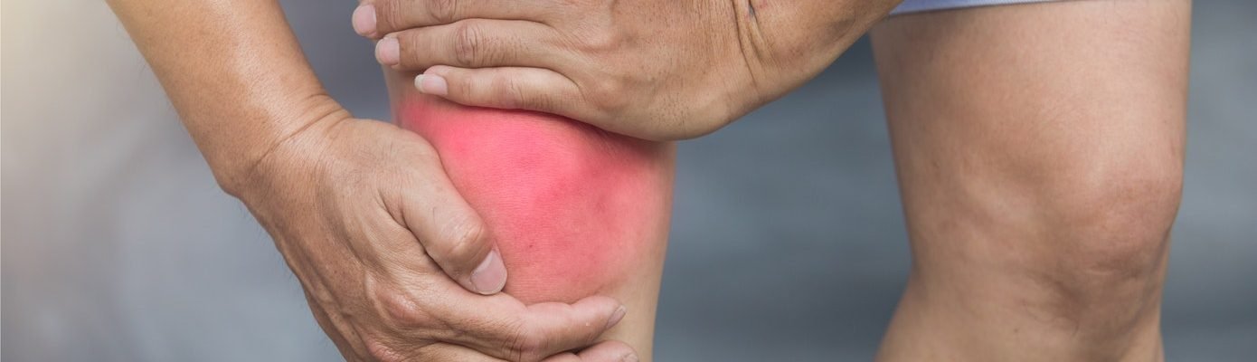 Ano ang gamot sa rayuma o arthritis?