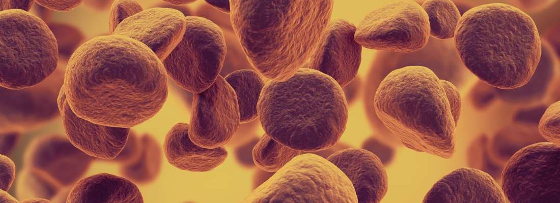 Leukemia (Kanser sa Dugo)