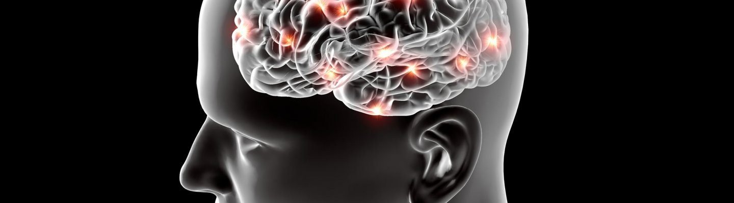 Alzheimer’s Disease