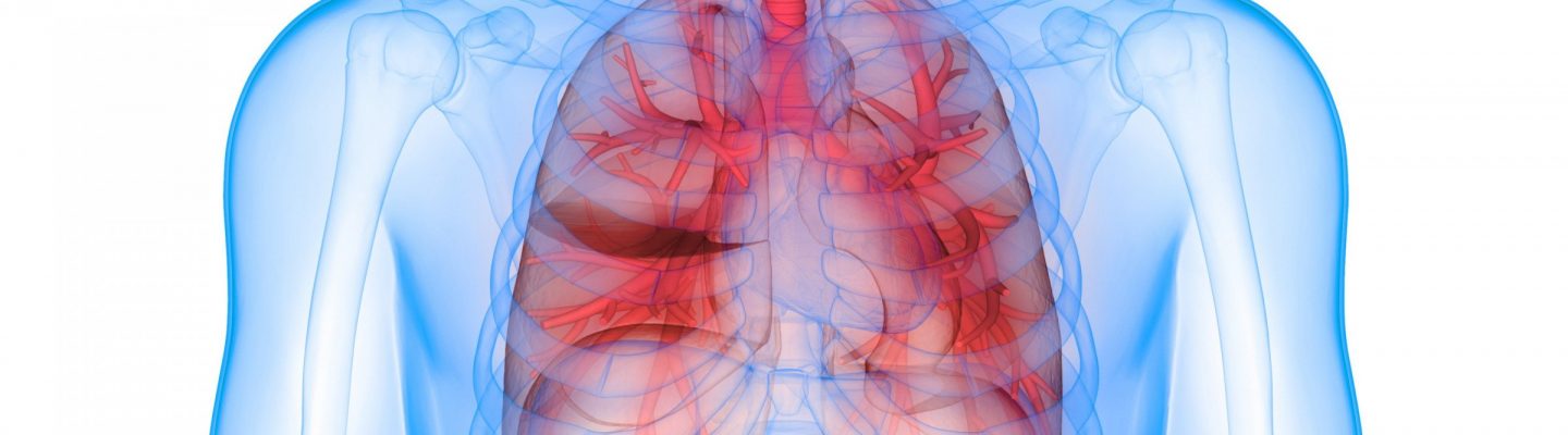 Pulmonya (Pneumonia)