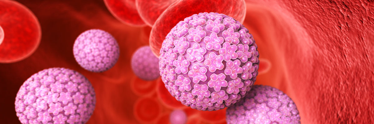 Kulugo sa Ari (Genital Warts)