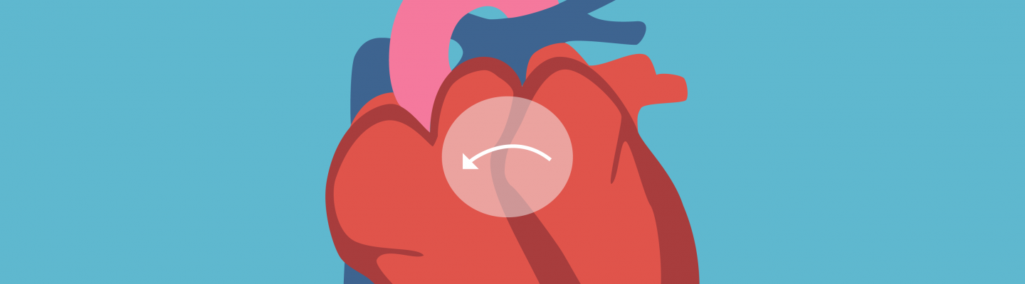 Congenital Heart Disease