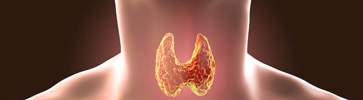 Hypothyroidism