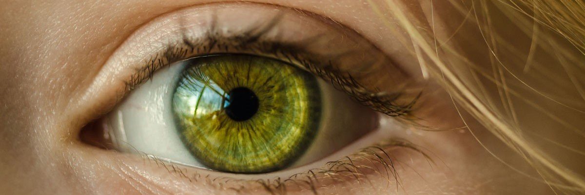 Astigmatismo (Astigmatism)