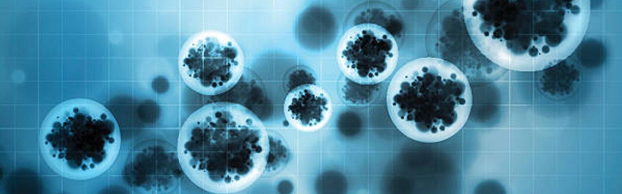 Tuberkulosis (Tuberculosis)