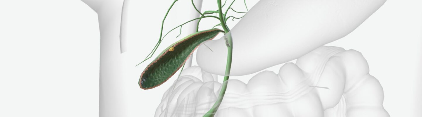 Polyp sa Loob ng Apdo (Gallbladder Polyps)