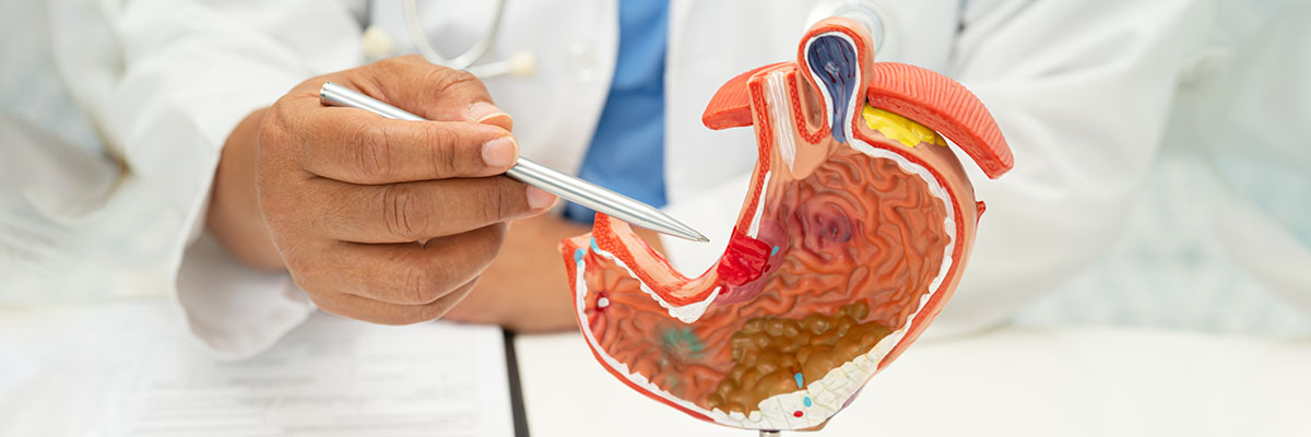 Kanser sa Tiyan (Stomach Cancer)