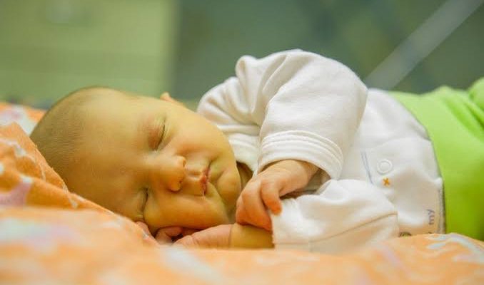 Paninilaw ng Sanggol (Infant Jaundice)