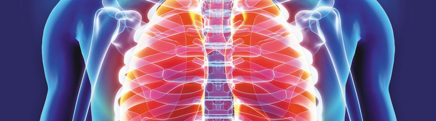 Acute Bronchitis