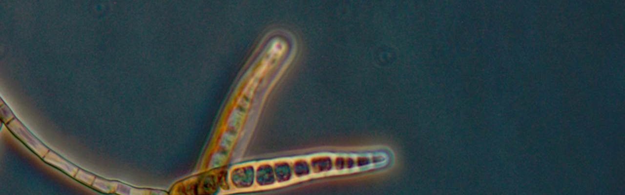Fungal Meningitis sa Amerika: 137 apektado, 12 patay