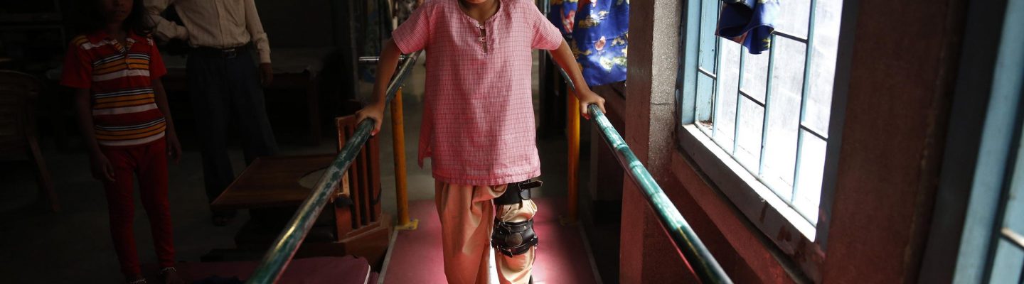 Ano ang sintomas ng polio?