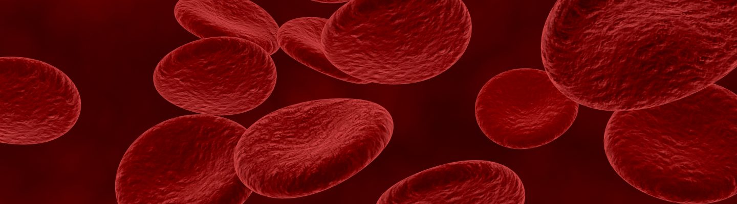 Septicemia