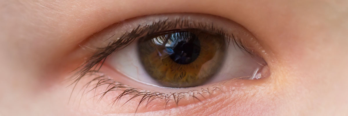 Kanser sa Mata (Eye Cancer)