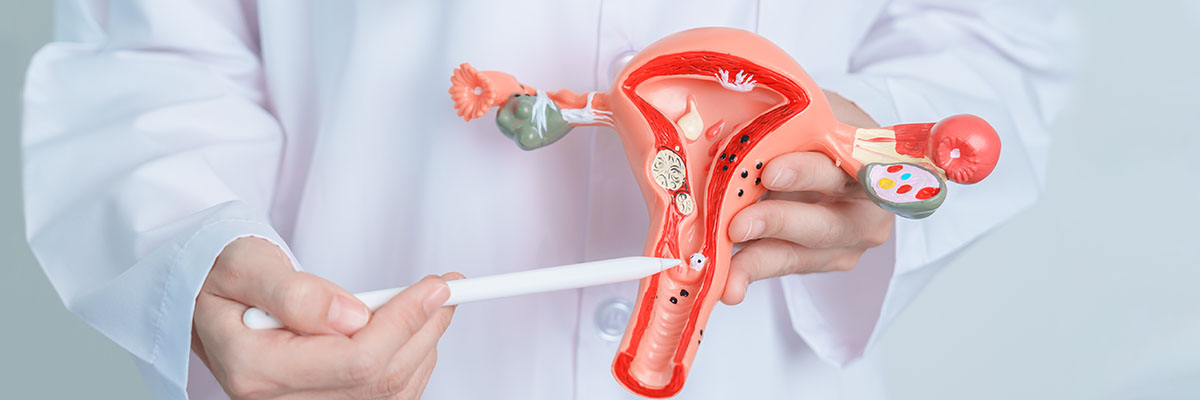 Kanser sa Matris (Endometrial Cancer/Uterine Cancer)