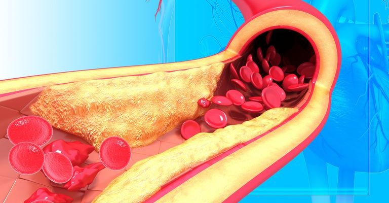 Ang masama at mabuting cholesterol