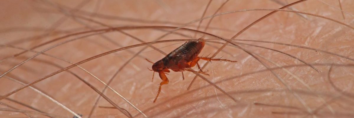 Tipus (Typhus Fever)