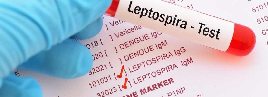Paano malaman kung may leptospirosis?