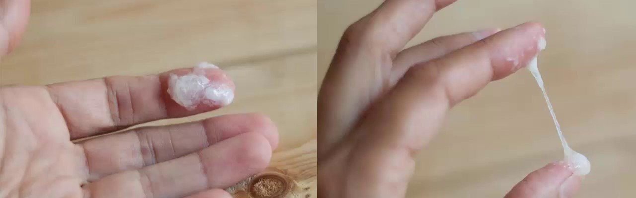 Vaginal discharge, tulo, ‘white mens’, at iba pang lumalabas sa pwerta ng babae