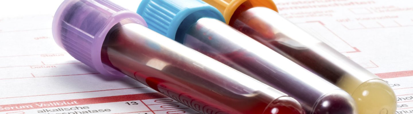 Mga kaalaman tungkol sa Pagsusuri ng Dugo o Blood Testing