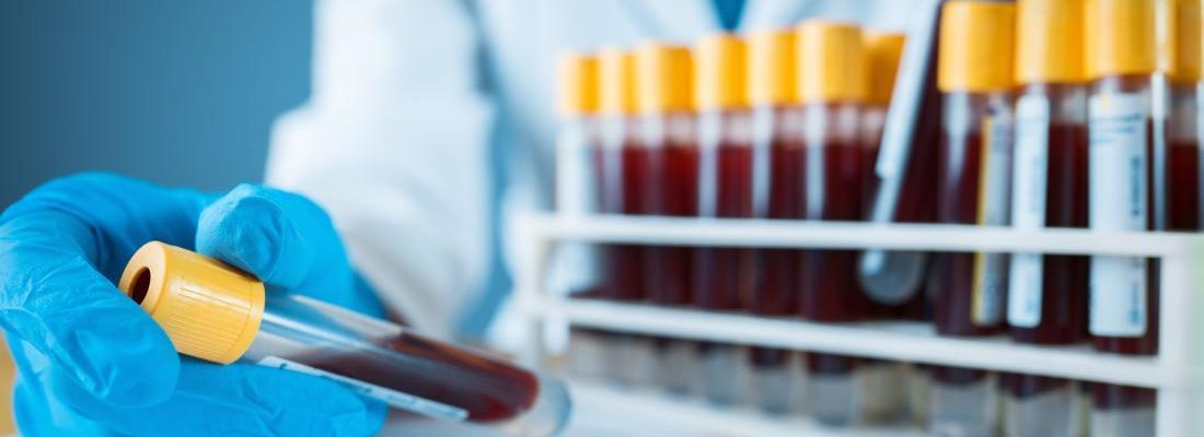 Blood Chemistry