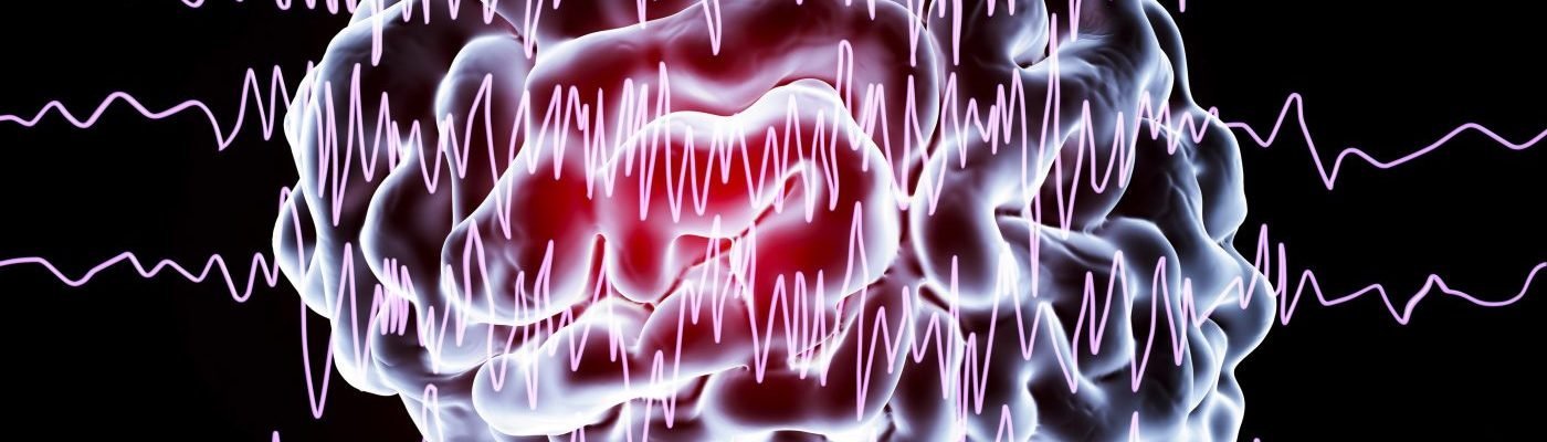 Paano malaman kung may epilepsy?