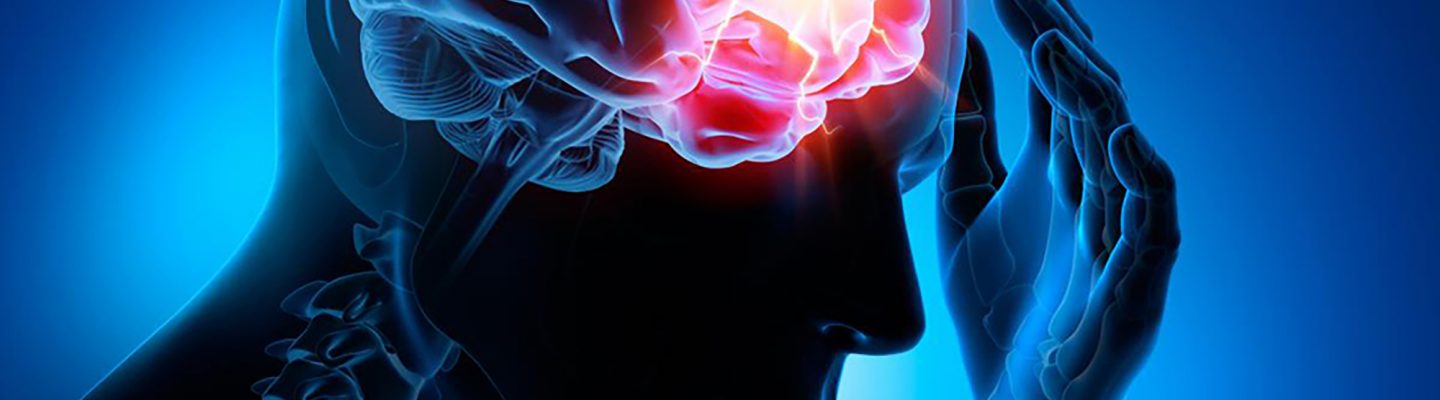 Epilepsy