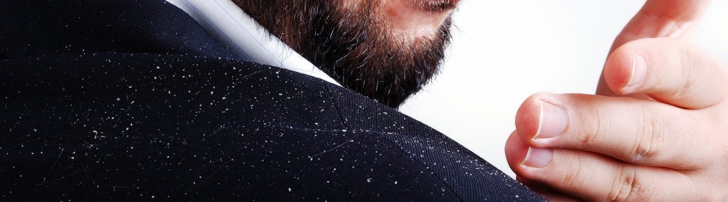 Ano ang sintomas ng balakubak o dandruff?