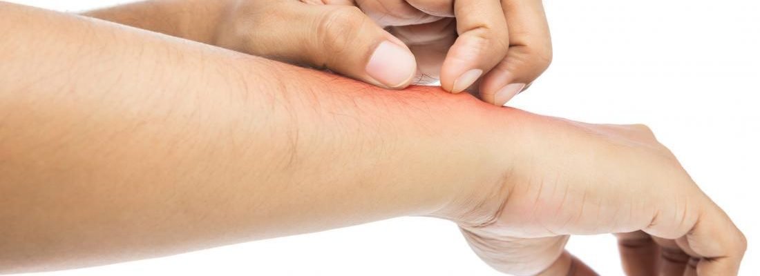 Paano malaman kung may allergy?