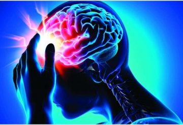 cause of stroke