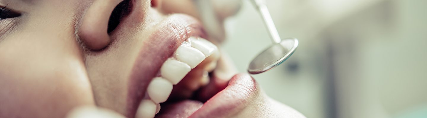 Bulok na Ngipin (Tooth Decay)